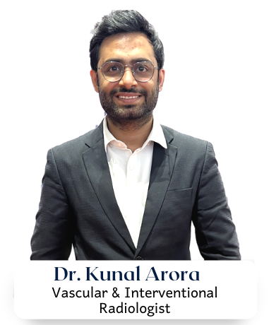 What are the stages of varicose veins?, by Dr Kunal Arora, Interventional  Radiologist in Mum