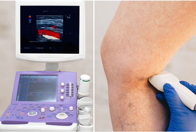 Ankle–brachial pressure index