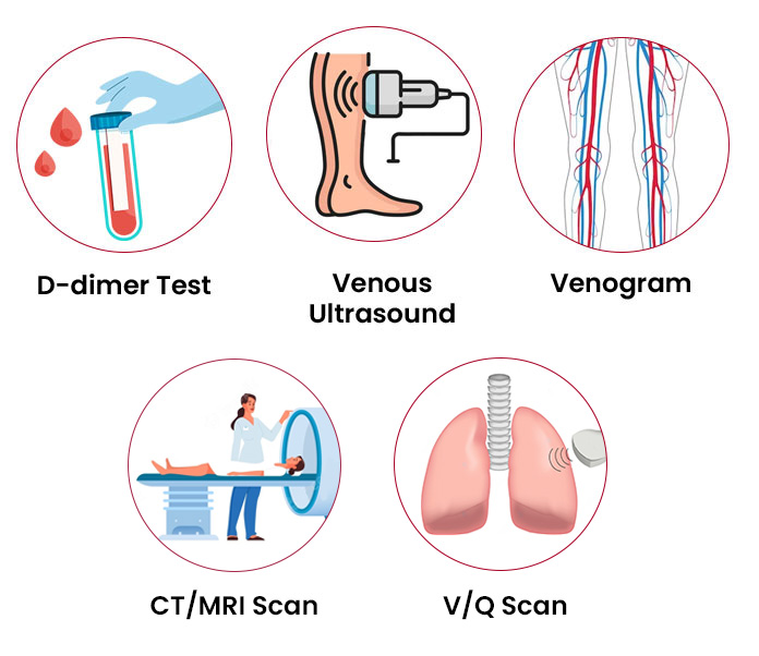 diagnose of dvt