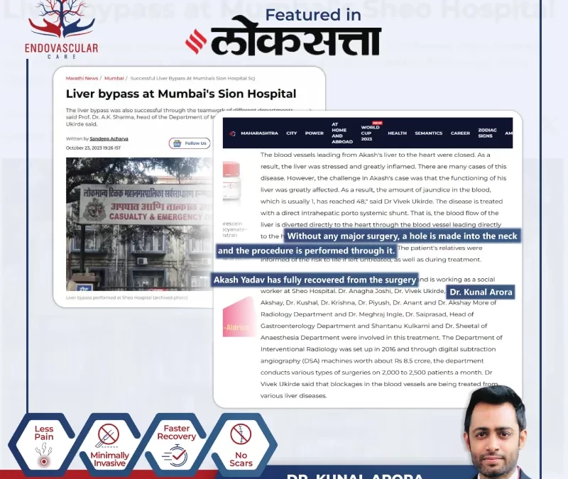 Liver Bypass at Mumbai’s Sion Hospital