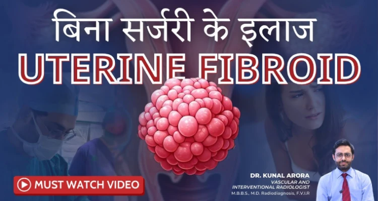 Uterine Fibroids Treatment Without Surgery in Mumbai