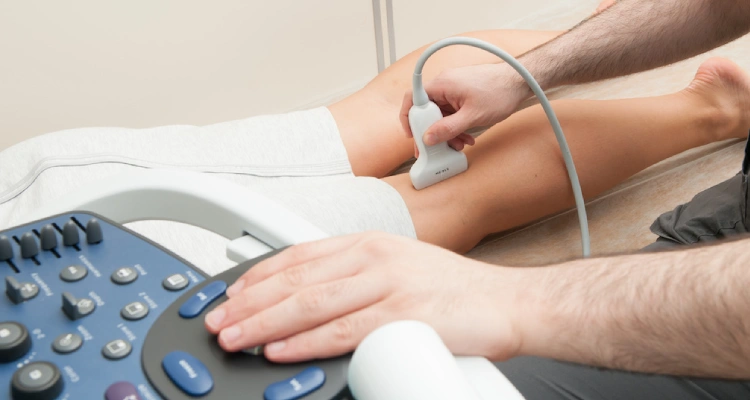 Common Tests for Diagnosing Varicose Veins