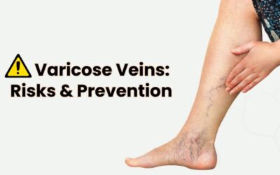 Understanding Varicose Vein Complications and Prevention
