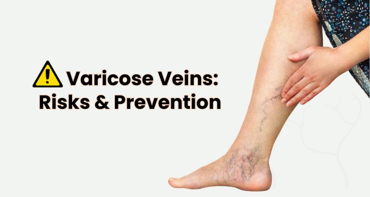 Understanding Varicose Vein Complications and Prevention