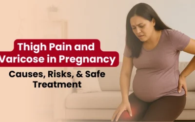 Thigh Pain and Varicose in Pregnancy: Causes, Risks, and Safe Treatment