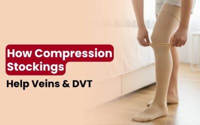 How Compression Stockings Help Veins & DVT