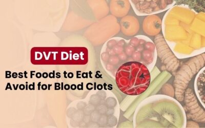 DVT Diet: Best Foods to Eat & Avoid for Blood Clots