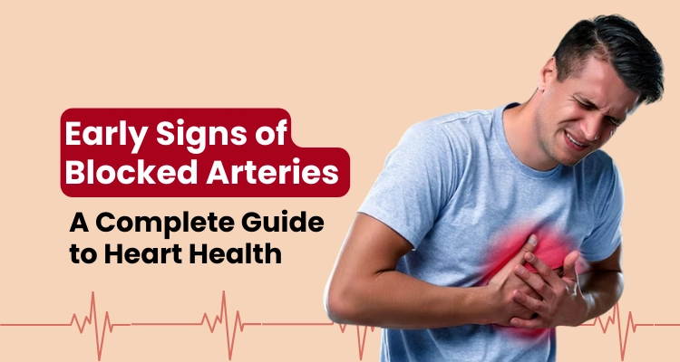 Early Signs of Blocked Arteries