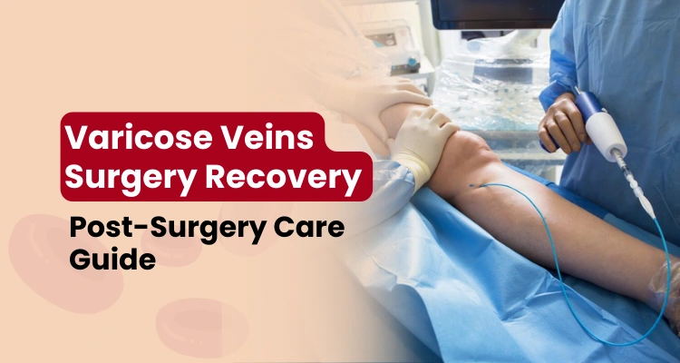 Varicose Veins Surgery Recovery Varicose Veins Surgery Recovery