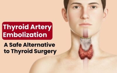 Thyroid Artery Embolization: A Safe Alternative to Thyroid Surgery