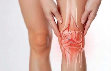 Genicular Artery Embolisation Genicular Artery Embolisation