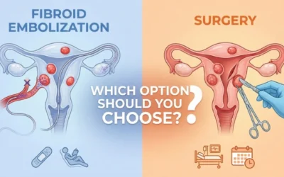 Fibroid Embolization vs Surgery: Which Treatment Is Right for You?