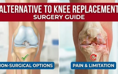 Alternative to Knee Replacement Surgery Guide