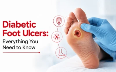 Diabetic Foot Ulcers: Everything You Need to Know