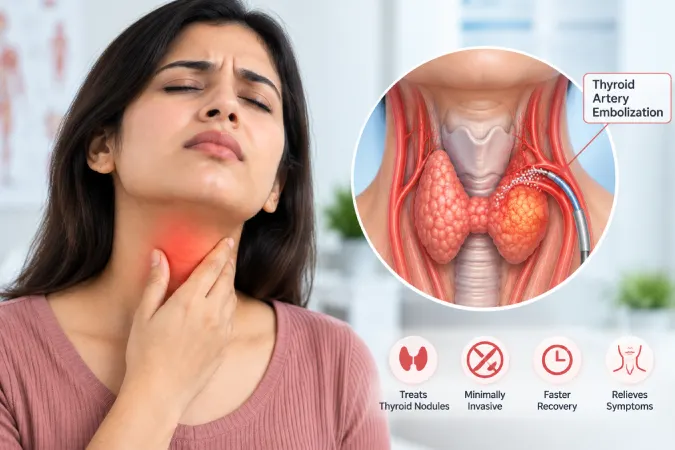 Thyroid Artery Embolization in Goregaon